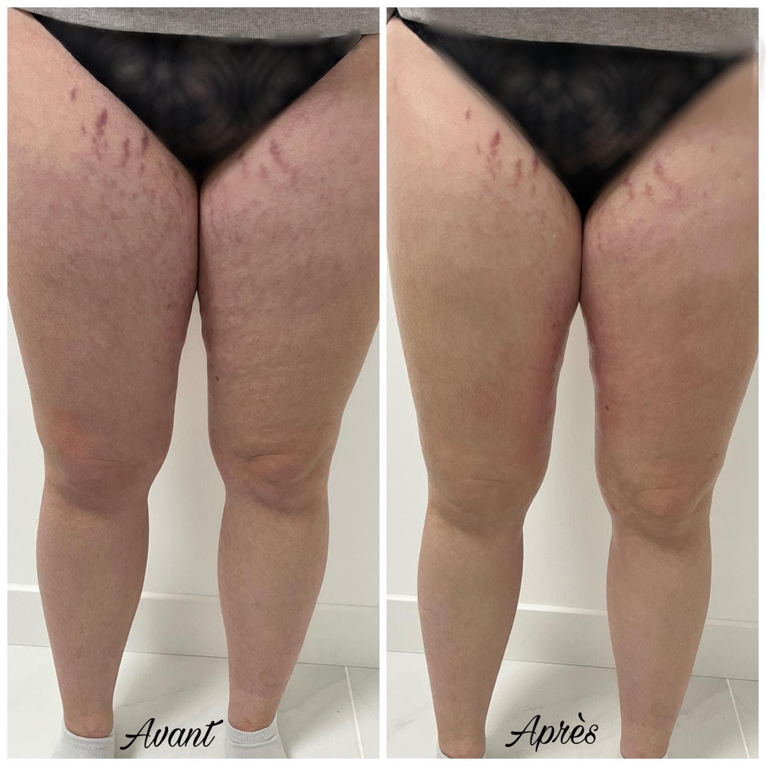 Silhouette · jambes — réalisation présentée par Cinq Beautés